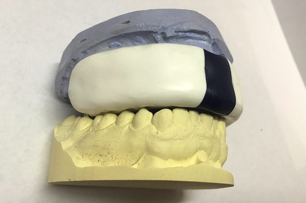 custom layered mouthguard